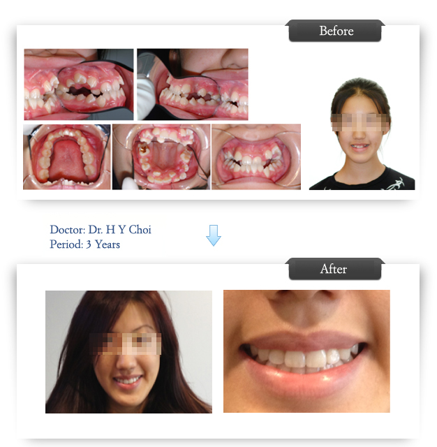 Orawell dental Orthodontics